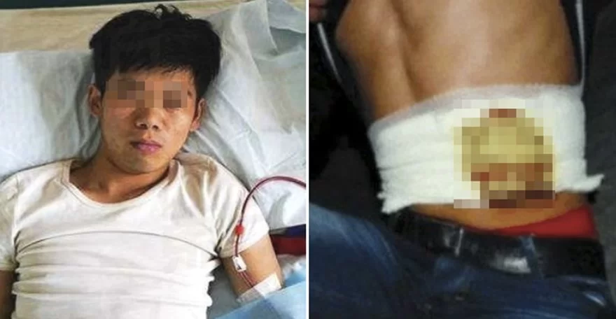 7 years ago this man sold his kidney for rm13000 to buy iphone 4 | iPhone 4 | บทเรียนชีวิตผ่านไป 7 ปี หนุ่มขายไตเพื่อซื้อ iPhone 4 ชีวิตพังสุขภาพแย่ !!