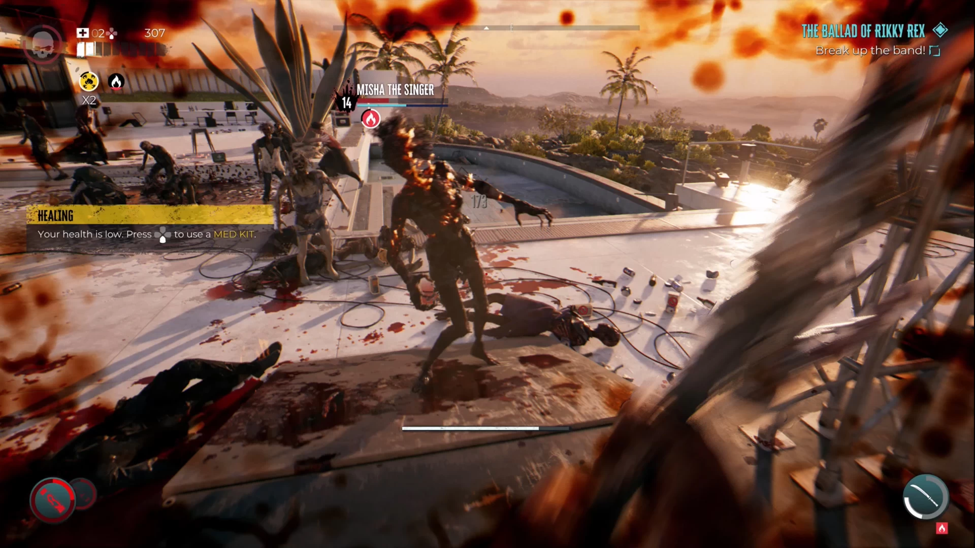 6 | Dead Island 2 | รีวิว Dead Island 2 - เกมภาคต่อที่รอคอยมานานถึง 8 ปี (PlayStation 5)