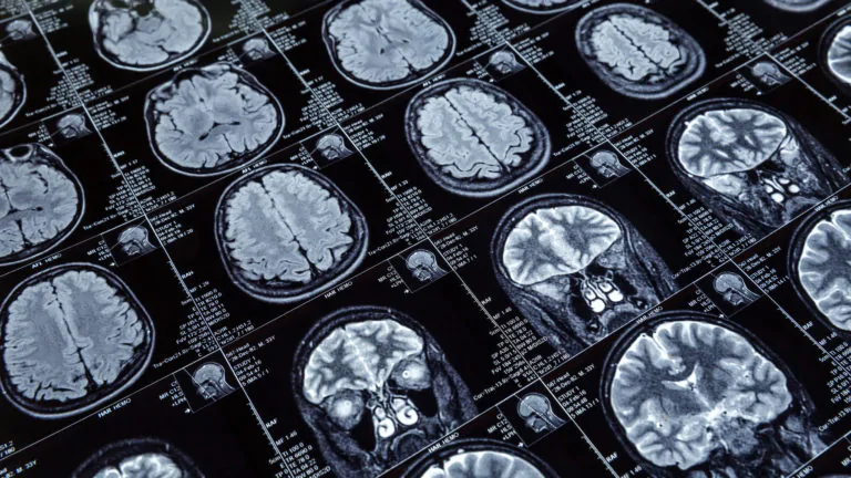 ai mind vis fmri 1 | AI | นักวิจัยสร้าง AI ที่สามารถอ่านใจมนุษย์ได้ถึง 85% หวังเป็นตัวช่วยผู้พิการทางสื่อสาร 